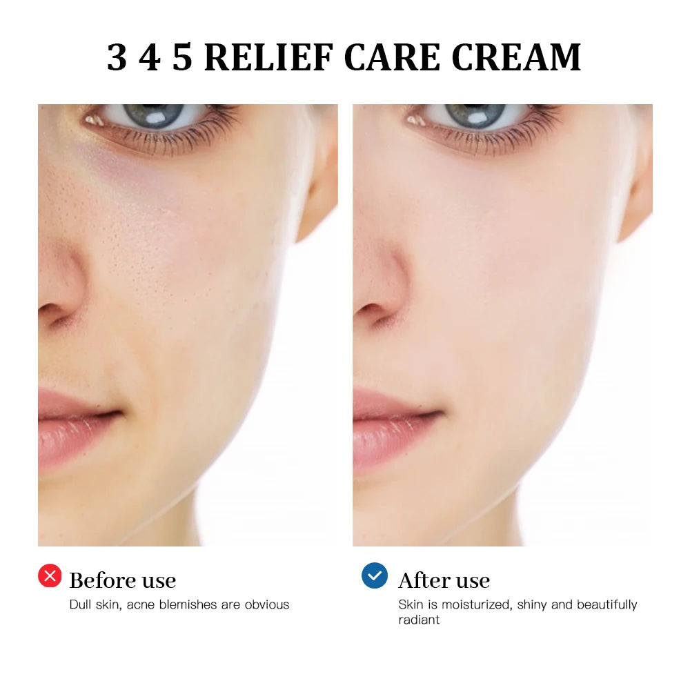 345 Relief Cream - Ultimate Solution for Skin Problems, Anti-Sugar & Antioxidant, Brightening Blemish Care, Nourishing Moisturizer from Korea